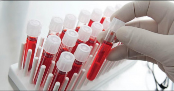 رشد ۳۳ درصدی ذخیره سازی خون بند ناف در استان سمنان