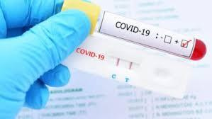 تشخیص همزمان کووید ۱۹ و آنفلوآنزا به روش Real-time PCR