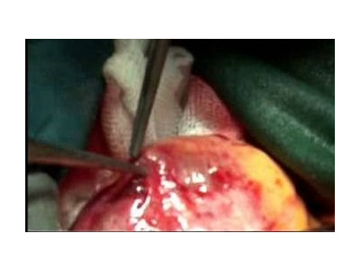 دستيابي به دانش فني سلول درمانی