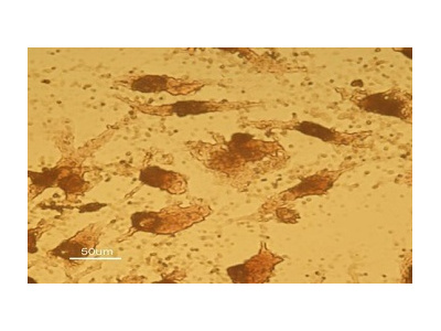 دستیابی به دانش فنی سلولهاي بنيادين بالغ