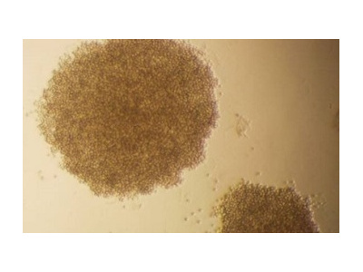 آنتيباديهاي تك دودماني