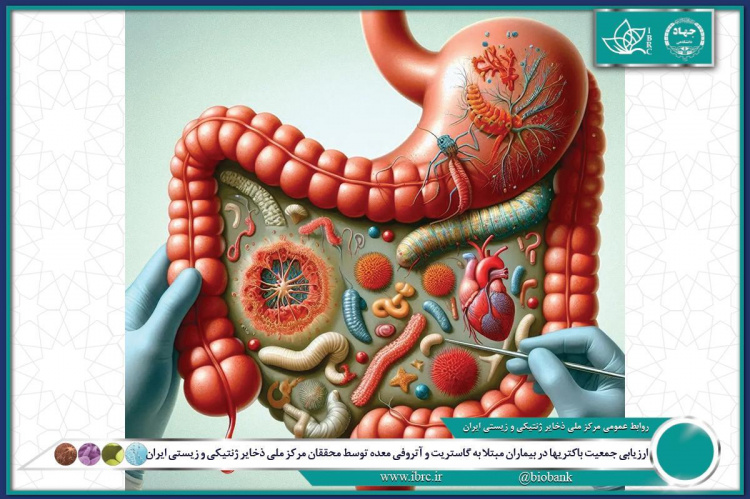 ارزیابی جمعیت باکتری‌ها در بیماران مبتلا به گاستریت و آتروفی معده