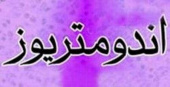 دستاورد پژوهشگاه ابنسینا جهاددانشگاهی؛ مکمل آنتیاکسیدانی «ان-استیلسیستئین»؛ امید تازه برای کاهش درد آندومتریوز