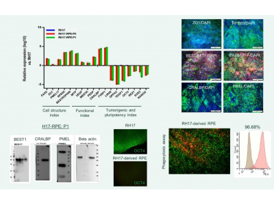 تولید صنعتی محصول سلولهای اپیتلیال رنگدانهدار شبکیه تمایز یافته از سلولهای بنیادی جنینی انسانی
