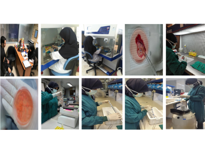 انجماد و نگهداری گناد انسانی( بافت تخمدان)