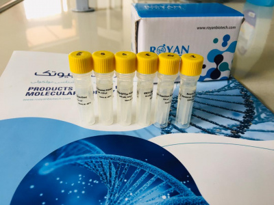 تولید پروتئین نوترکیب و کیت سنتز cDNA