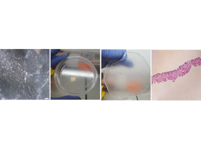 فناوری افزایش کارآیی سلول درمانی تدوین دانش فنی و ساخت زخم پوشهای آتروماتیک غیرچسبنده)