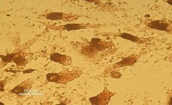 دستیابی به دانش فنی سلول‌هاي بنيادين بالغ