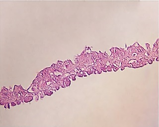 تولید صنعتی ورقه کراتینوسیت