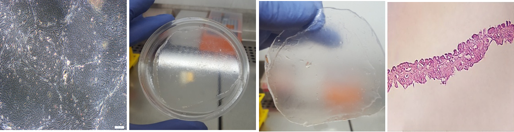 فناوری افزایش کارآیی سلول درمانی تدوین دانش فنی و ساخت زخم پوش‌های آتروماتیک غیرچسبنده)