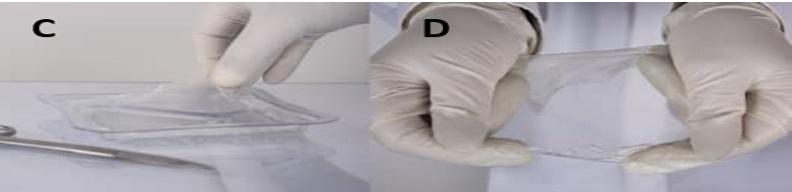 بررسی ایمنی و اثر بخشی استفاده از پانسمان استفاده از پانسمان هیدروپلیمری (هیدروژل) حاوی تیمول در درمان زخم های مزمن دیابتی نوروپاتیک: فاز اول و دوم کارآزمایی بالینی